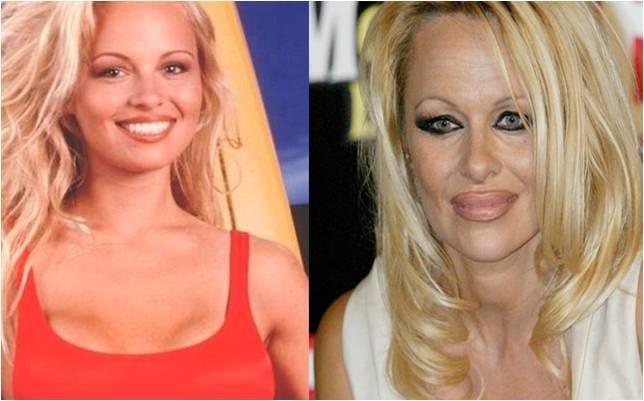 Vừa bơm môi vừa tham lam tô son tràn viền khiến gương mặt Pamela Anderson nhìn có phần già nua.