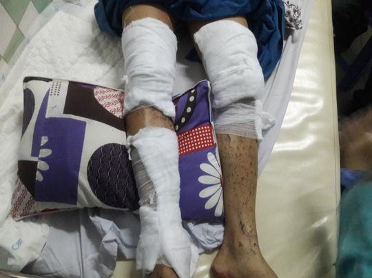 Vụ tạt axít dã man ở Quảng Ngãi: Các đối tượng ra tay chưa đầy 20 giây-2