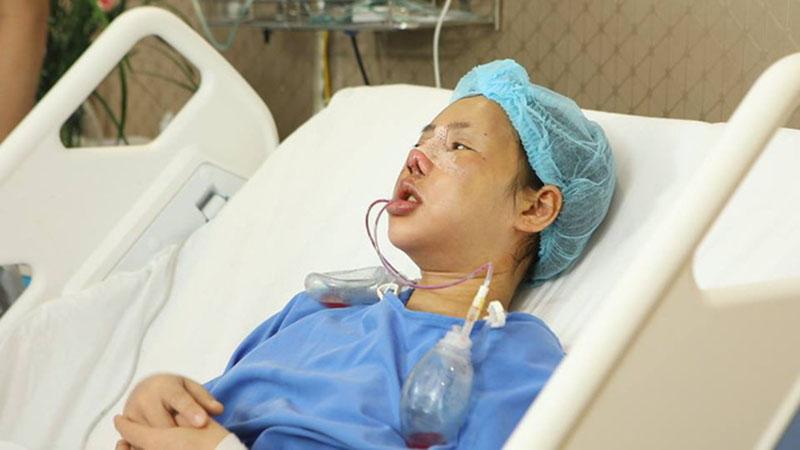 Gặp tai nạn trong ngày tốt nghiệp đại học, cô gái trẻ 2 lần thẩm mỹ hỏng, lần thứ 3 lột xác khiến người thân giật mình-2