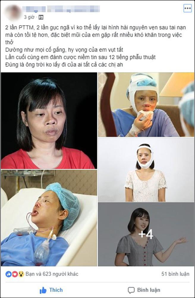 Gặp tai nạn trong ngày tốt nghiệp đại học, cô gái trẻ 2 lần thẩm mỹ hỏng, lần thứ 3 lột xác khiến người thân giật mình-1