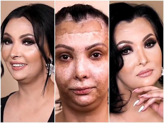 Sức mạnh của nghệ thuật trang điểm: biến người phụ nữ bị hỏng da mặt trở nên quý phái