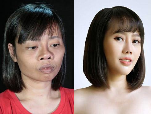 Gặp tai nạn trong ngày tốt nghiệp đại học, cô gái trẻ 2 lần thẩm mỹ hỏng, lần thứ 3 lột xác khiến người thân giật mình