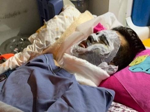 Manh mối về nghi can vụ tạt axit Việt kiều Canada khi về thăm quê-2