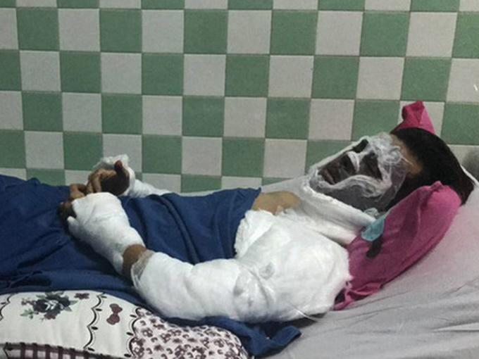 Thông tin mới nhất vụ Việt kiều bị tạt axit, cắt gân chân ở Quảng Ngãi-2