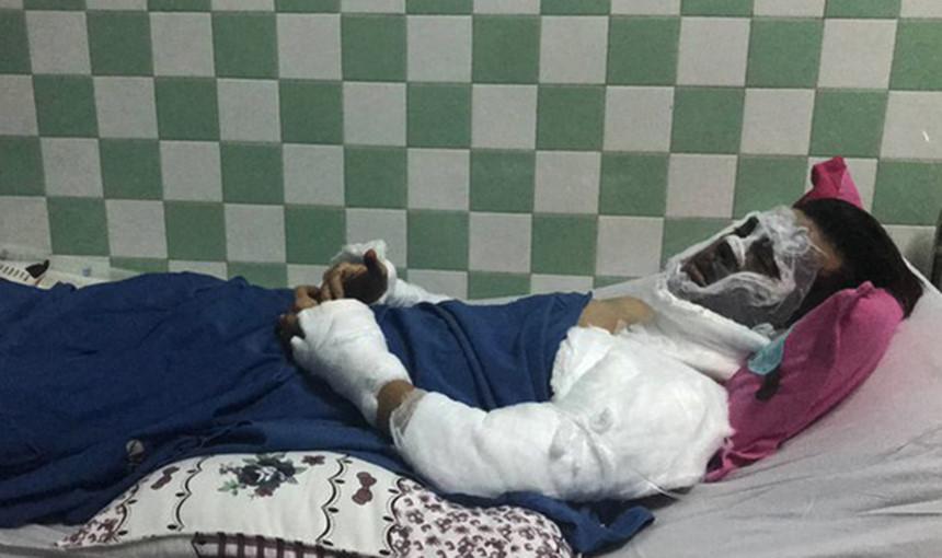 Việt kiều bị tạt axit ngày Tết: Đôi mắt bị tổn thương nặng-1