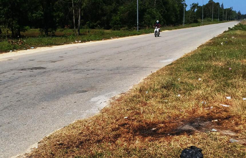 Việt kiều bị tạt axit ngày Tết: Đôi mắt bị tổn thương nặng-2