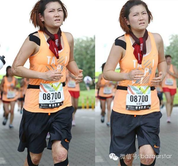 S.H.E Selina vẫn tự tin pose dáng dù đôi chân chằng chịt sẹo sau tai nạn bỏng toàn thân 8 năm trước-7