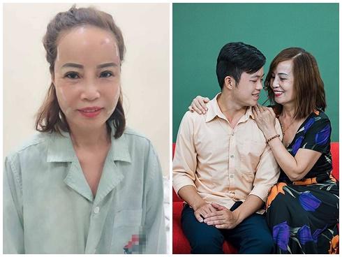 Cô dâu Cao Bằng 62 tuổi lấy chú rể 26 tuổi sức khỏe yếu hậu thẩm mỹ