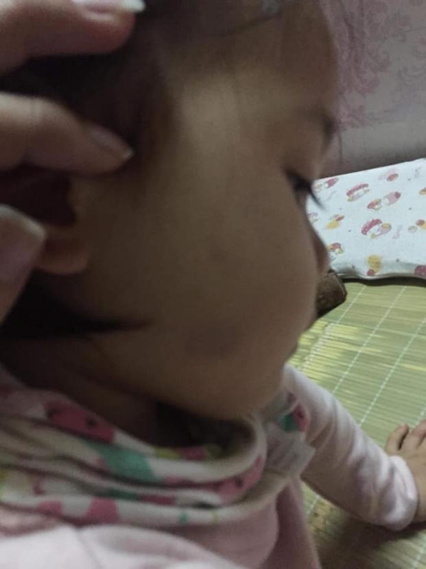 Bé mầm non ở Hà Nội bị cô giáo lôi ra góc lớp tát tới tấp vì không chịu ăn-2