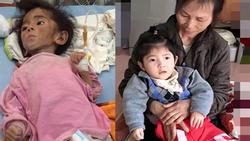 Gần 3 năm được nhận nuôi, đến cả mẹ nuôi cũng xuýt xoa trước ngoại hình cao lớn của bé gái suy dinh dưỡng ở Lào Cai