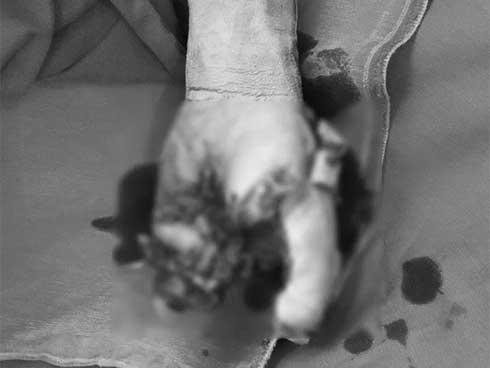 Vừa chơi game vừa sạc pin điện thoại, 1 cháu bé suýt mất mạng-2