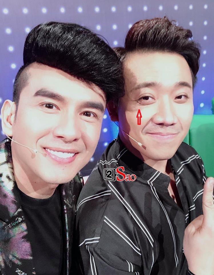 Trấn Thành hớn hở khoe đã giảm được cân nhưng ai nấy đều xót xa khi thấy anh lộ rõ dấu hiệu tuổi tác-9