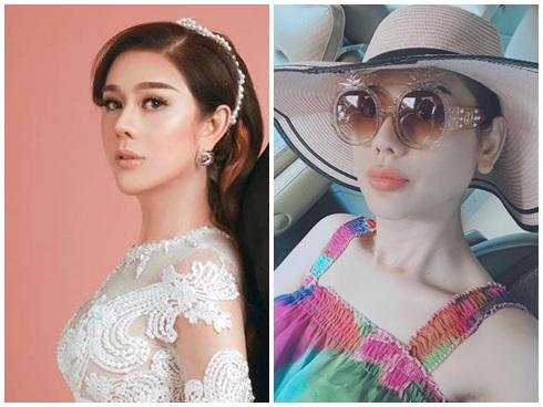 Hết gây sửng sốt với ảnh livestream cắt mí sưng vù, Lâm Khánh Chi lại tiếp tục bơm môi trùng tu nhan sắc-3