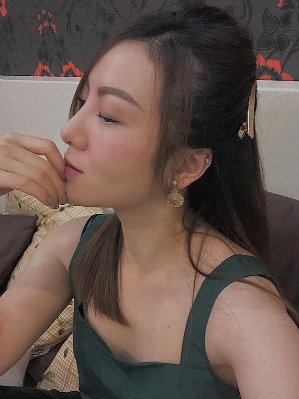 Loạt sao Việt dao kéo giờ thay đổi ra sao: Phi Thanh Vân xuống cấp, Ngân Anh môi hết sưng, được khen ngợi xinh đẹp-11