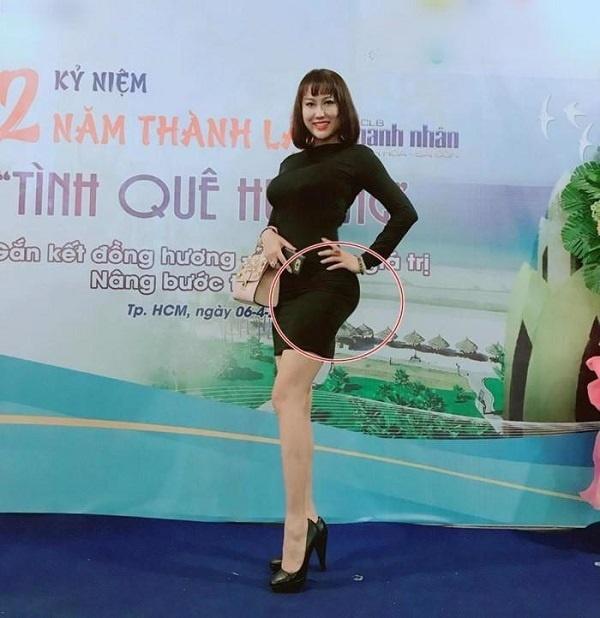 Loạt sao Việt dao kéo giờ thay đổi ra sao: Phi Thanh Vân xuống cấp, Ngân Anh môi hết sưng, được khen ngợi xinh đẹp-4