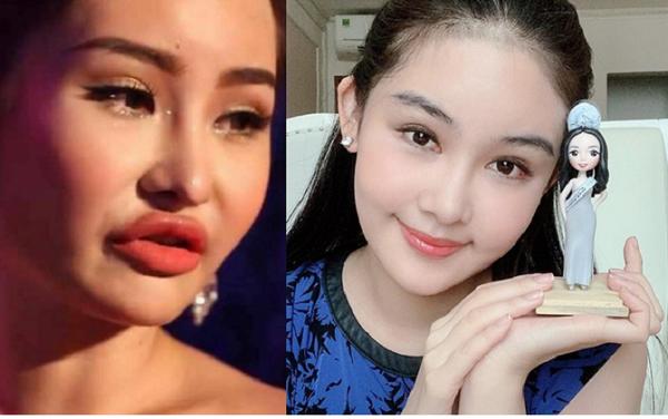 Loạt sao Việt dao kéo giờ thay đổi ra sao: Phi Thanh Vân xuống cấp, Ngân Anh môi hết sưng, được khen ngợi xinh đẹp-5