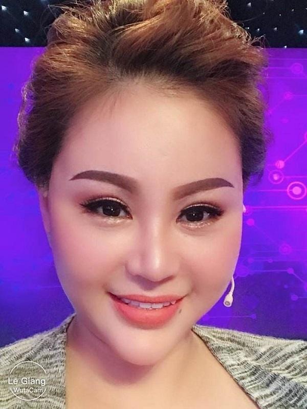 Loạt sao Việt dao kéo giờ thay đổi ra sao: Phi Thanh Vân xuống cấp, Ngân Anh môi hết sưng, được khen ngợi xinh đẹp-9