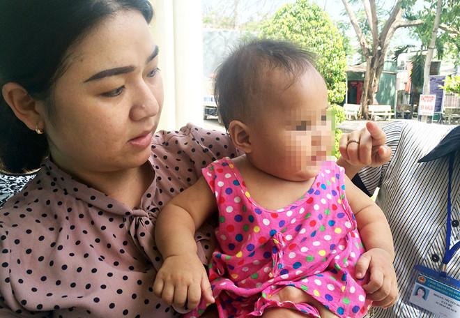 Bé gái 8 tháng tuổi nghi bị mẹ nuôi bạo hành, nhốt trong phòng trọ-1