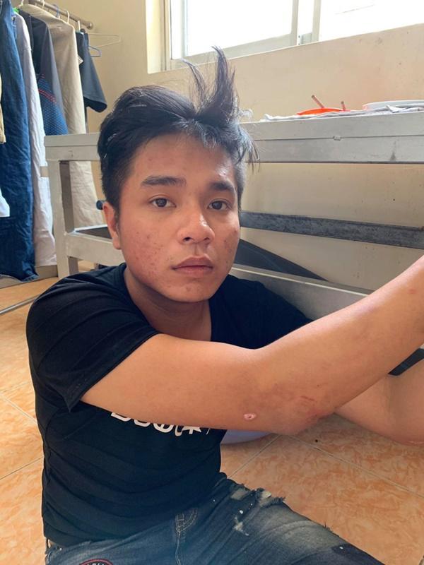 Bắt băng nhóm cướp giật giỏ xách, kéo lê người phụ nữ mang thai ở Sài Gòn-1