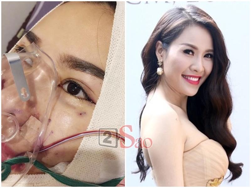 Loạt sao Việt nghiện khoe dung nhan dù biết rõ đẹp nhờ phẫu thuật thẩm mỹ-3