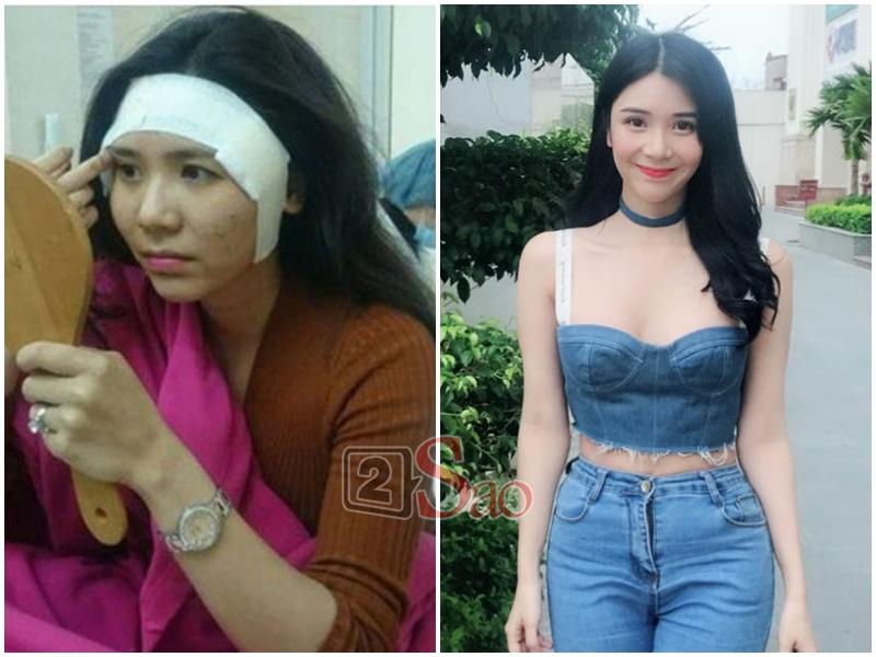 Loạt sao Việt nghiện khoe dung nhan dù biết rõ đẹp nhờ phẫu thuật thẩm mỹ-8