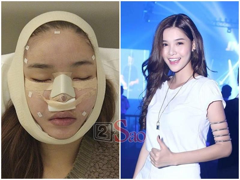 Loạt sao Việt nghiện khoe dung nhan dù biết rõ đẹp nhờ phẫu thuật thẩm mỹ-9