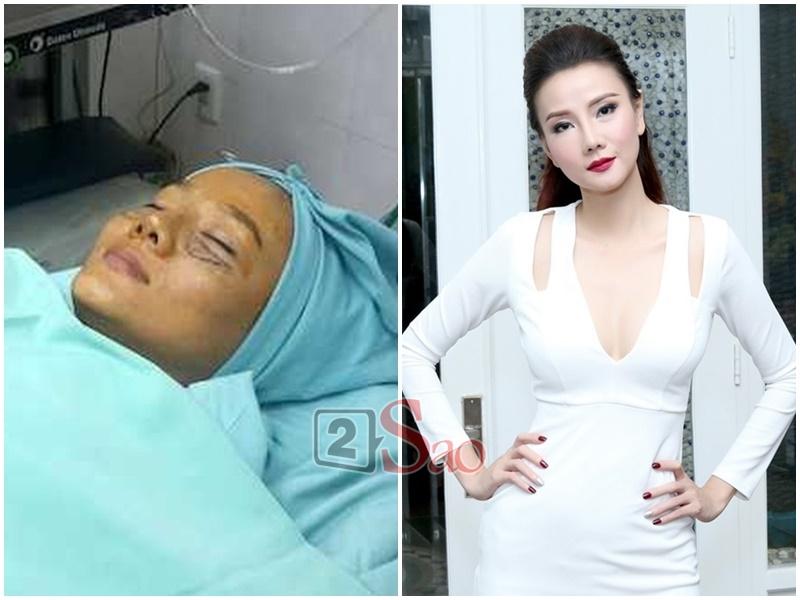 Loạt sao Việt nghiện khoe dung nhan dù biết rõ đẹp nhờ phẫu thuật thẩm mỹ-12