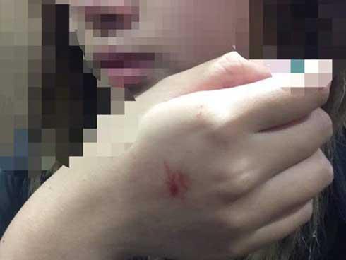 Nỗi ám ảnh của nữ sinh bị sàm sỡ, cưỡng hôn trong thang máy