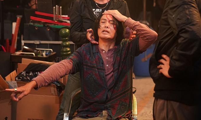 Châu Nhuận Phát bị đánh vỡ đầu trên trường quay-1