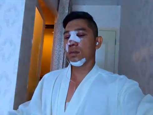 Người thân, đồng nghiệp đánh giá gương mặt đập đi xây lại của Lương Bằng Quang như thế nào?-7