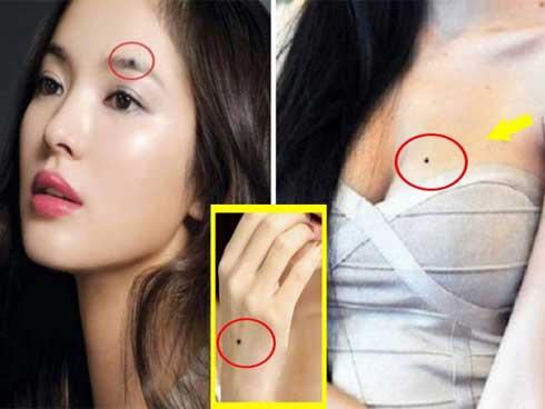 7 nốt ruồi đại phú quý của phụ nữ tuyệt đối không được tẩy xóa kẻo chặn đứng tài lộc, hôn nhân đổ vỡ-3