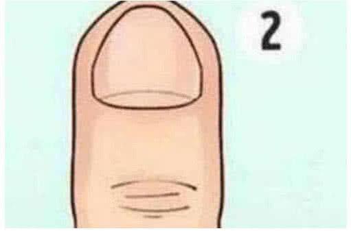 Nhìn ngón tay giữa đoán tính cách chuẩn không cần chỉnh-2