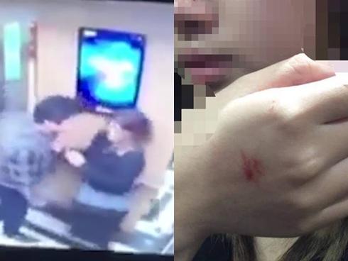 Sợ bị đánh, kẻ cưỡng hôn nữ sinh trong thang máy hoãn xin lỗi-2