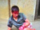 Bắc Giang: Thanh niên tâm thần bị hàng xóm chém 7 nhát vì làm đổ tường gạch và gãy cây cối trong vườn