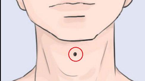 7 nốt ruồi đại phú quý của phụ nữ tuyệt đối không được tẩy xóa kẻo chặn đứng tài lộc, hôn nhân đổ vỡ-1