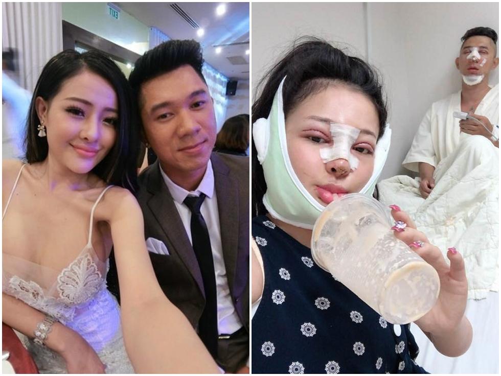Nhìn Lương Bằng Quang và Ngân 98 sau phẫu thuật chẳng khác nào quạ hóa công, ai cũng ấp ủ ước mơ đập mặt làm lại-15