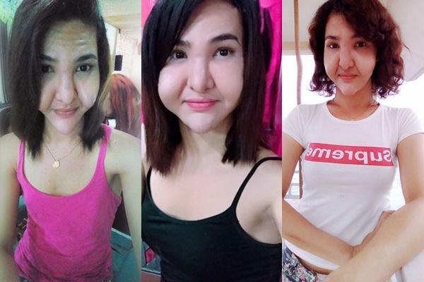 Đôi bạn chuyển giới rủ nhau đi phẫu thuật thẩm mỹ, đến khi bị biến chứng như quỷ dữ cũng phải có đôi có cặp-2