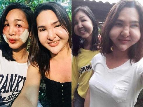 Gái xinh xuất hiện với chiếc cằm dài ngoằng, dân tình đoán già đoán non chắc do dao kéo quá đà đây mà-7