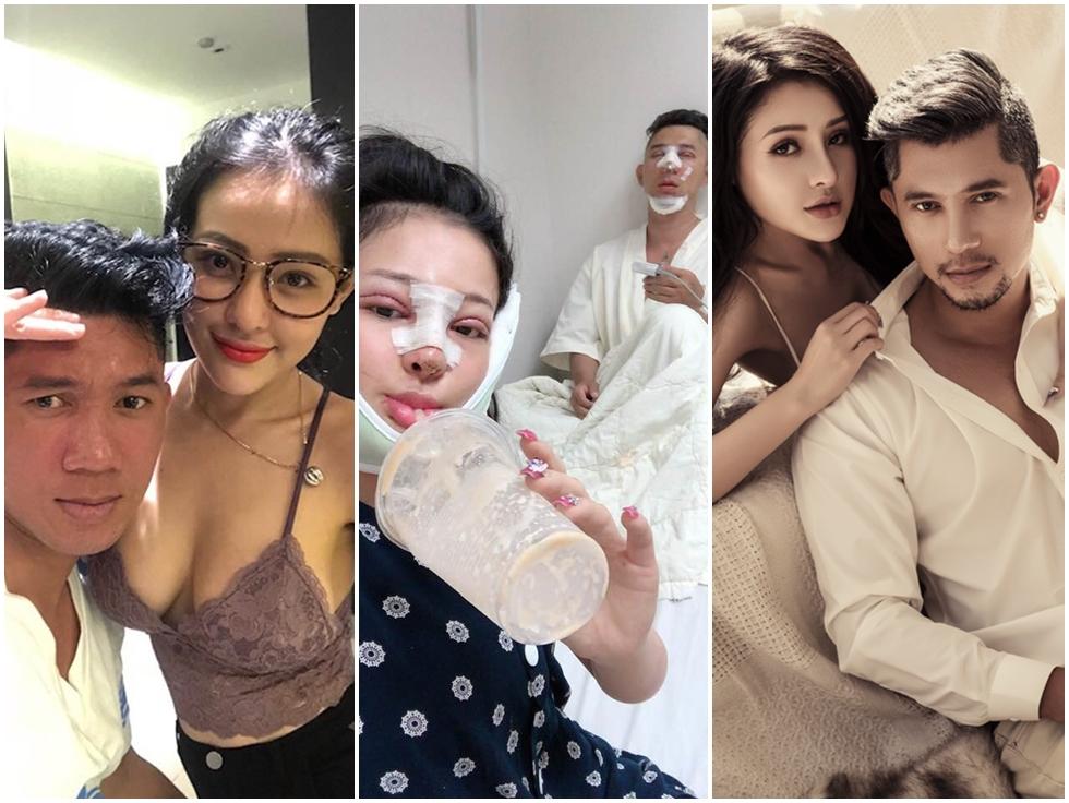 Vịt hóa thiên nga sau đại phẫu gương mặt, Lương Bằng Quang và Ngân 98 công khai giá khiến ai nấy rợn người-6