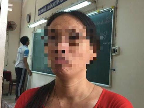 Cô giáo không nói gì lại bị đình chỉ vì ném vở học sinh-1