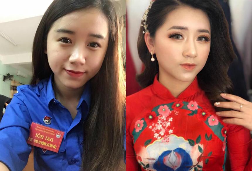 Giới trẻ dao kéo: Người vịt hóa thiên nga, kẻ bị gọi là ác quỷ-1