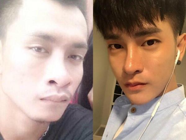 Giới trẻ dao kéo: Người vịt hóa thiên nga, kẻ bị gọi là ác quỷ-2