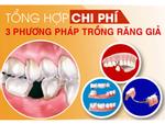 Tặng răng sứ khi trồng răng Implant ở Nha khoa Đông Nam