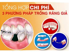 Tặng răng sứ khi trồng răng Implant ở Nha khoa Đông Nam Tặng răng sứ khi trồng răng Implant ở Nha khoa Đông Nam