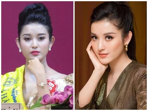 Hết mặt bánh bao ngâm nước, Á hậu Huyền My lại bị nghi sửa mũi hỏng thành dáng mũi diều hâu-10