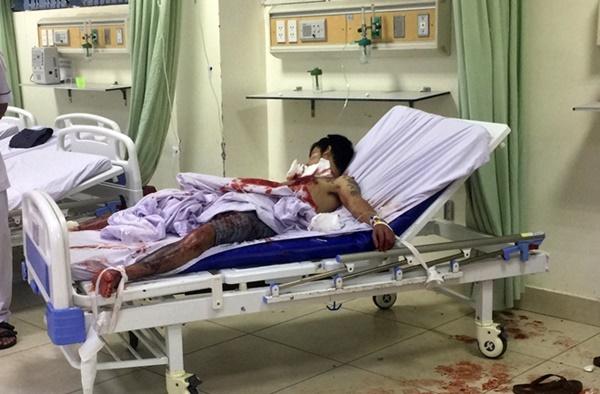 Nam thanh niên lên cơn ngáo đá tự cắt cổ, mổ ngực-1