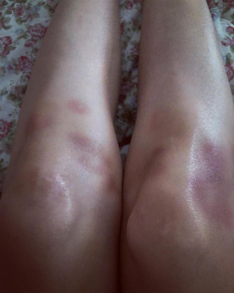 Còn đâu đôi chân cực phẩm đắt giá nhất làng giải trí Kpop, chuyện gì đang xảy ra với HyunA?-2