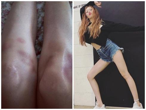 Chân dung chiếc áo khiến dàn nam thần Kpop kéo nhau đụng hàng chan chát dạo gần đây-9