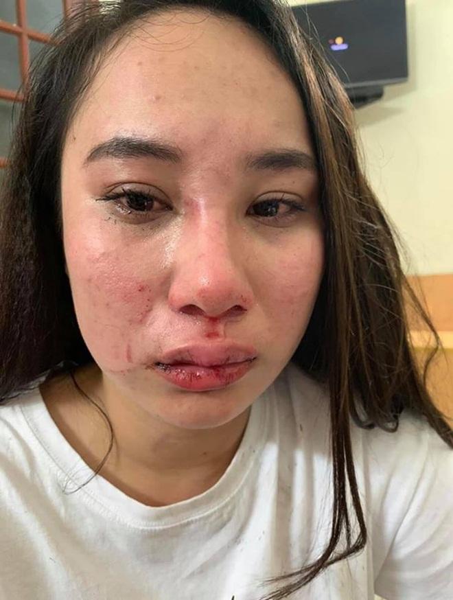 Cô gái bị đánh ghen ở Bà Triệu công khai vết thương, khẳng định oan ức và yêu cầu đưa bằng chứng con giáp 13-2