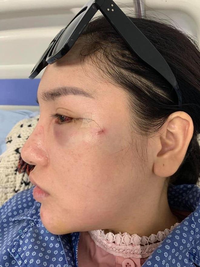 Cô gái bị đánh ghen ở Bà Triệu công khai vết thương, khẳng định oan ức và yêu cầu đưa bằng chứng con giáp 13-7